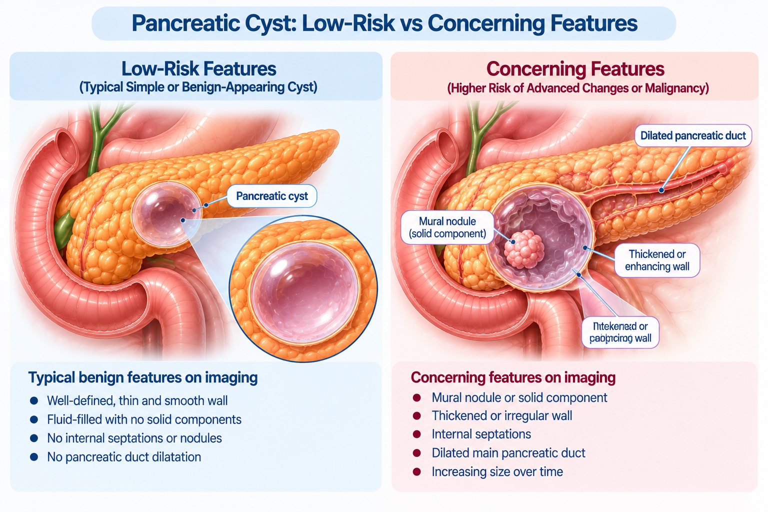 Pancreatic Cyst Risk Features Singapore