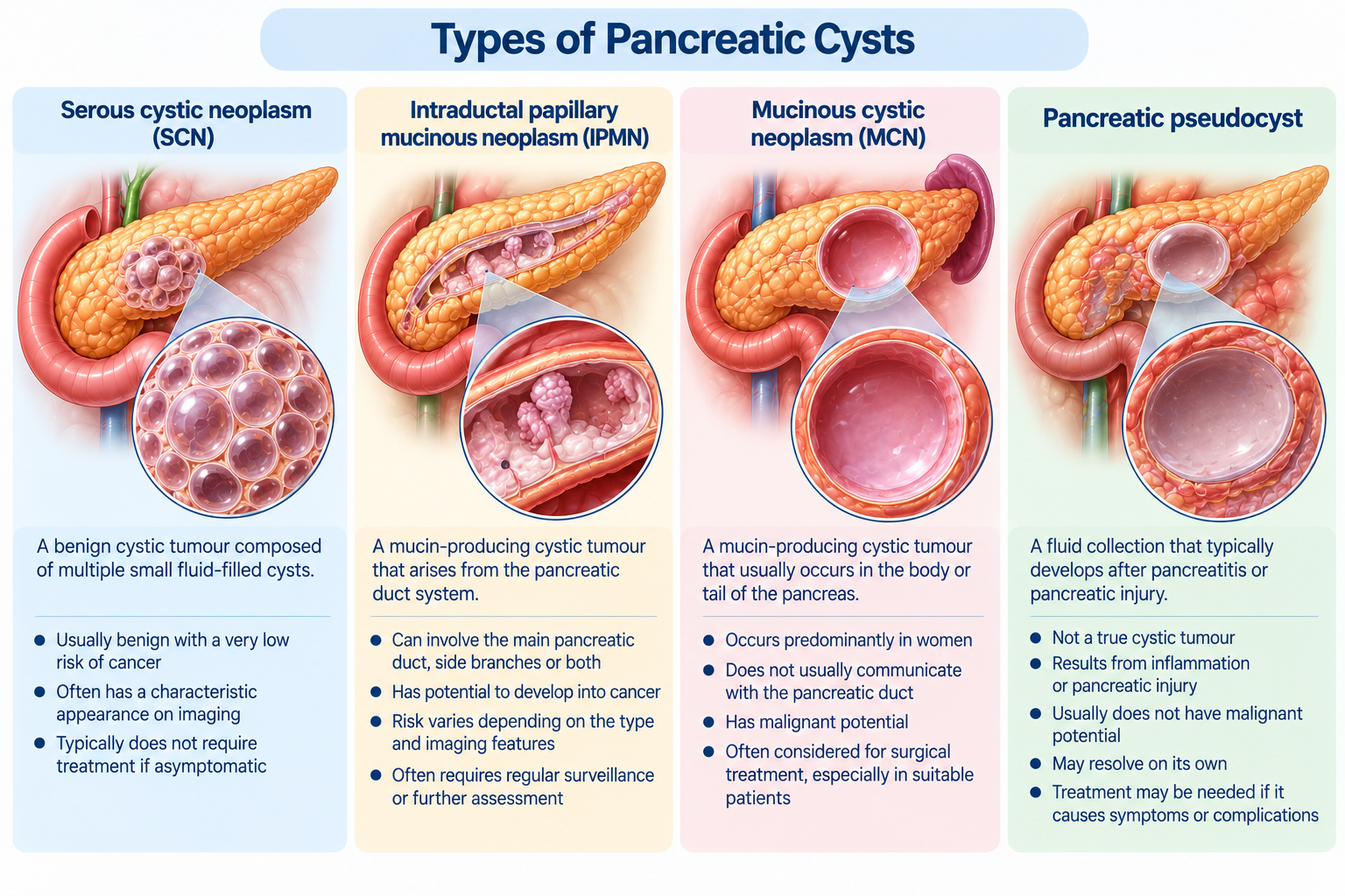 Types of Pancreatic Cysts Singapore