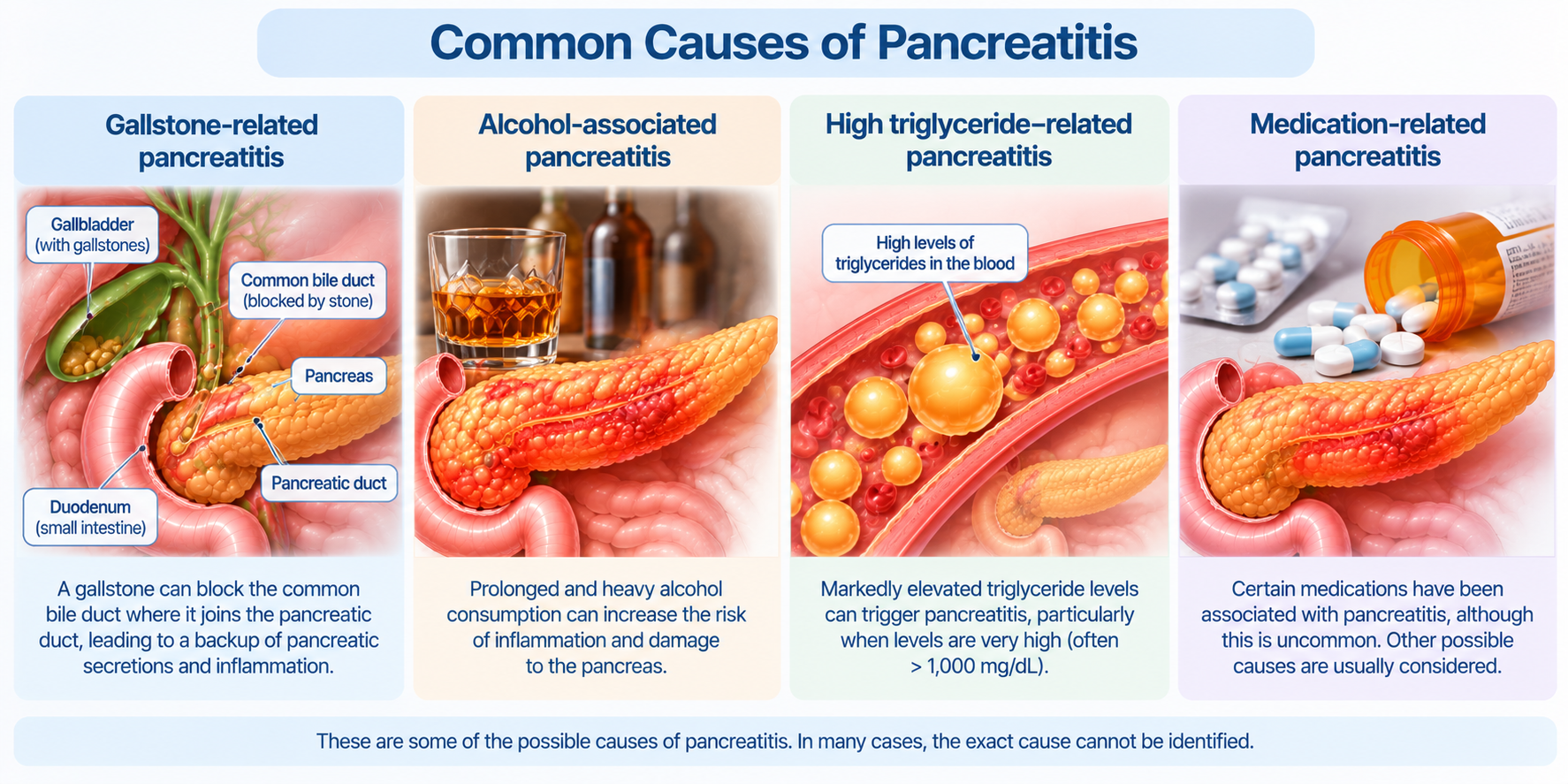 Common Causes of Pancreatitis Singapore