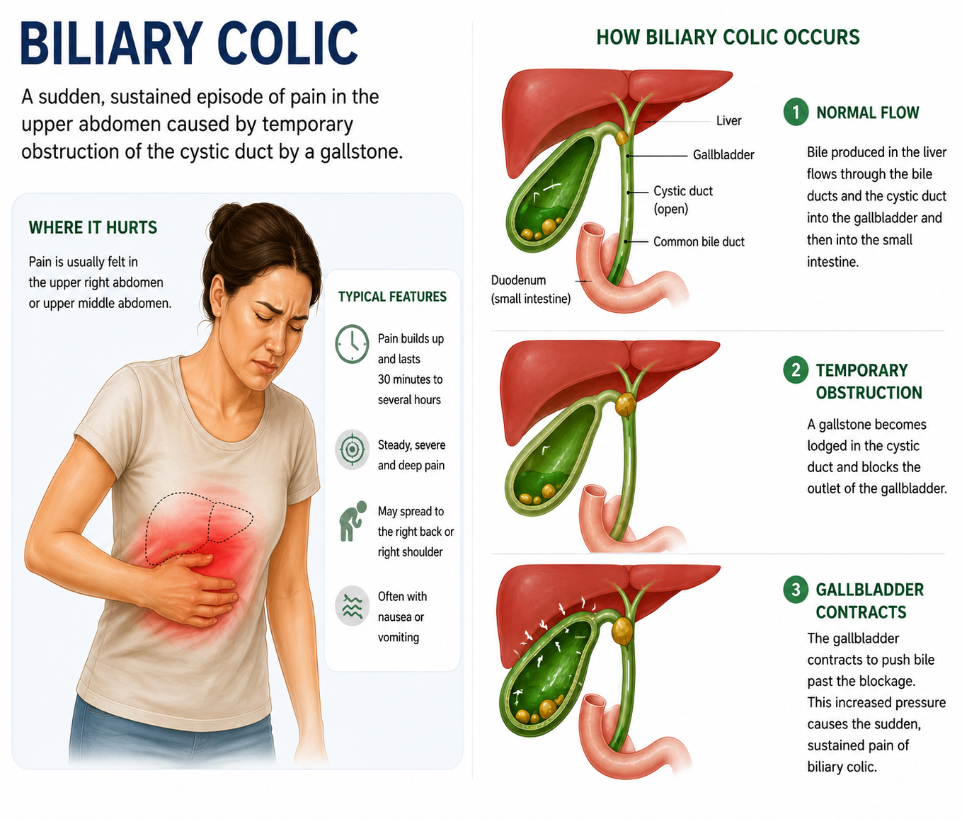 Biliary Colic Singapore